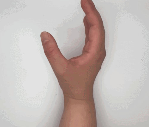 Close the hand