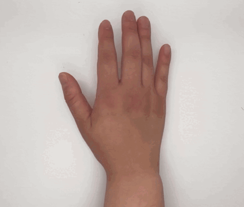 Forearm supination